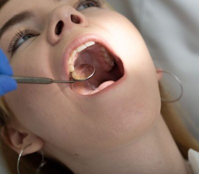 , Jak dbać o higienę jamy ustnej podczas leczenia ortodontycznego?