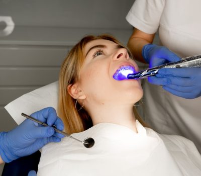, Wybielanie zębów lampą Beyond- czy warto skorzystać z tej metody?