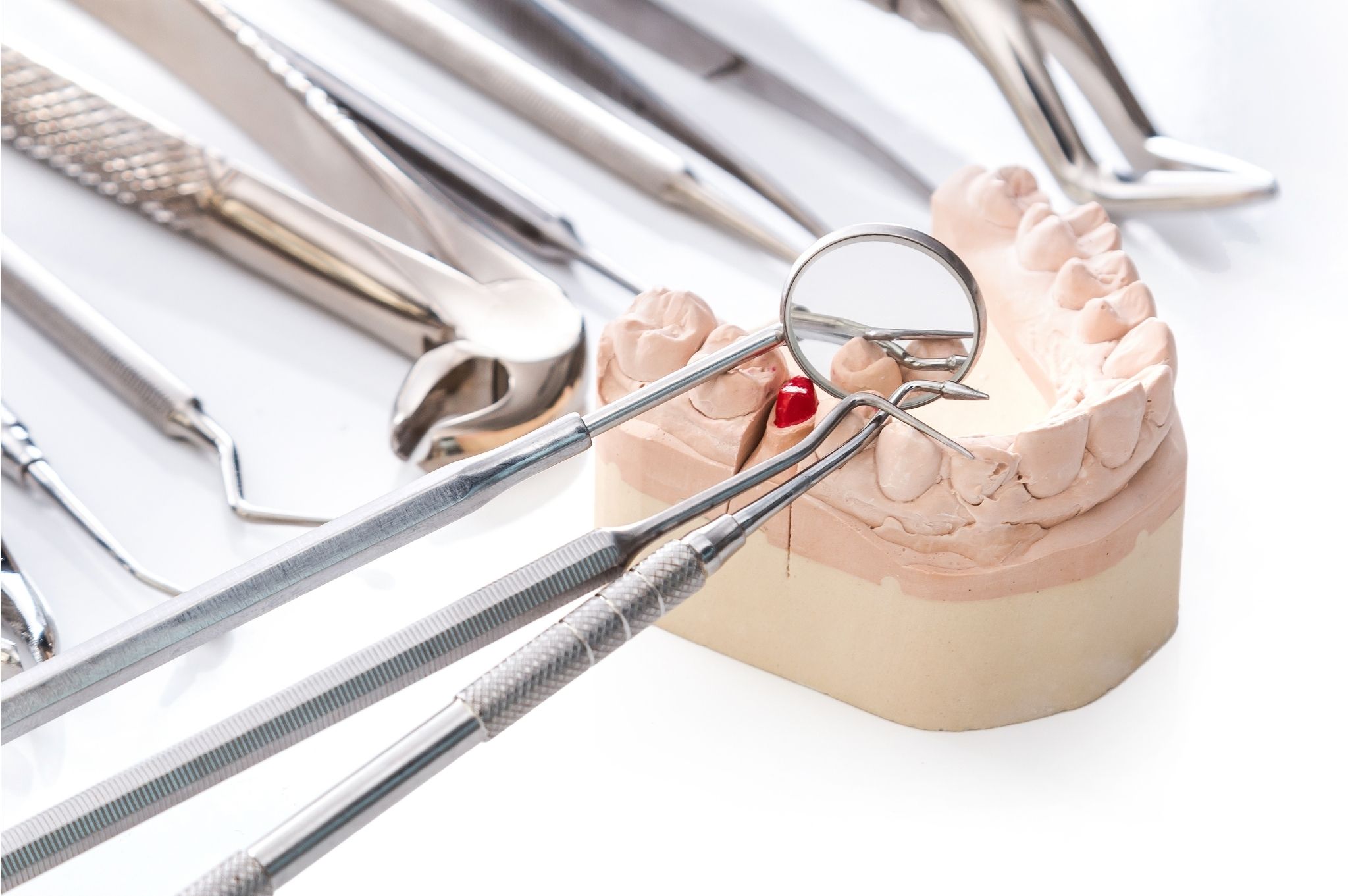 , Co to jest kiretaż zęb&oacute;w? Czy warto?