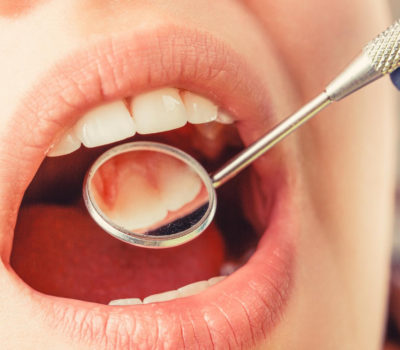 , Czy pr&oacute;chnica jest zaraźliwa?